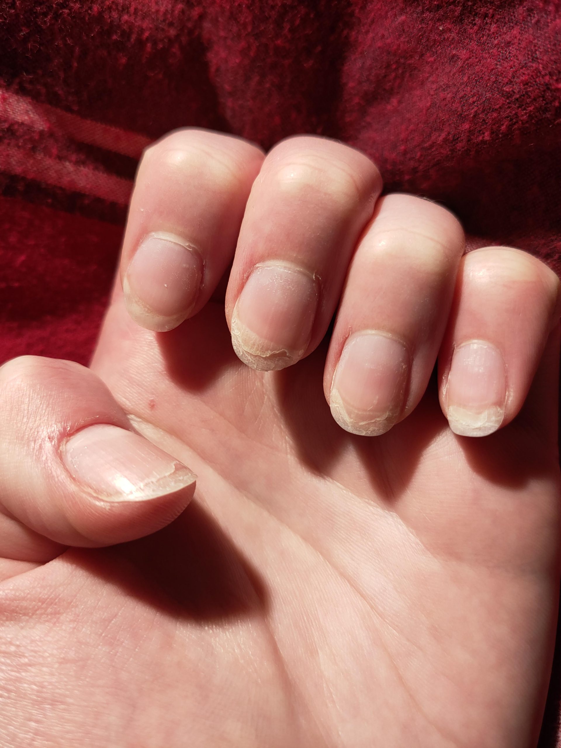 Are Polygel Nails Suitable For Weak Or Brittle Nails You Need To Know