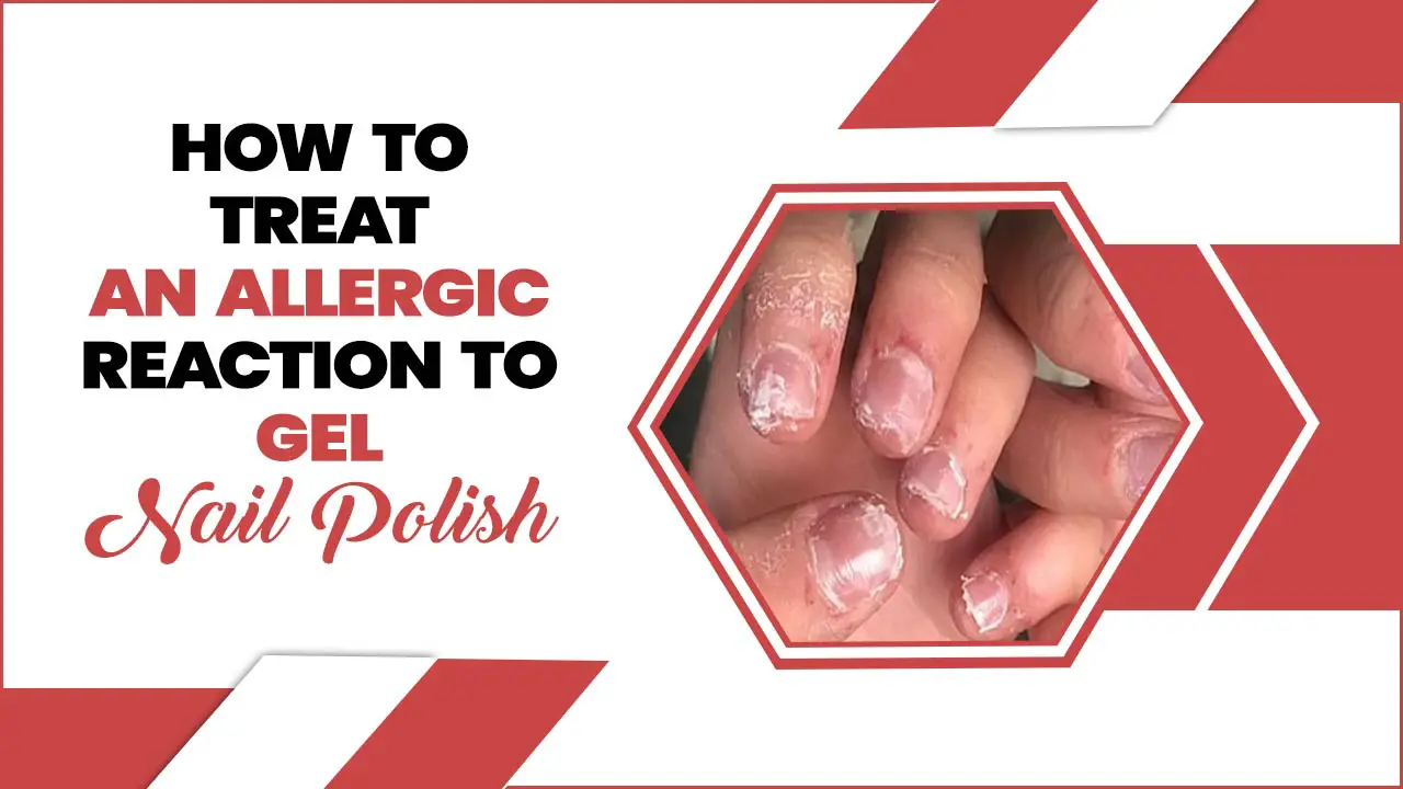 How To Treat An Allergic Reaction To Gel Nail Polish