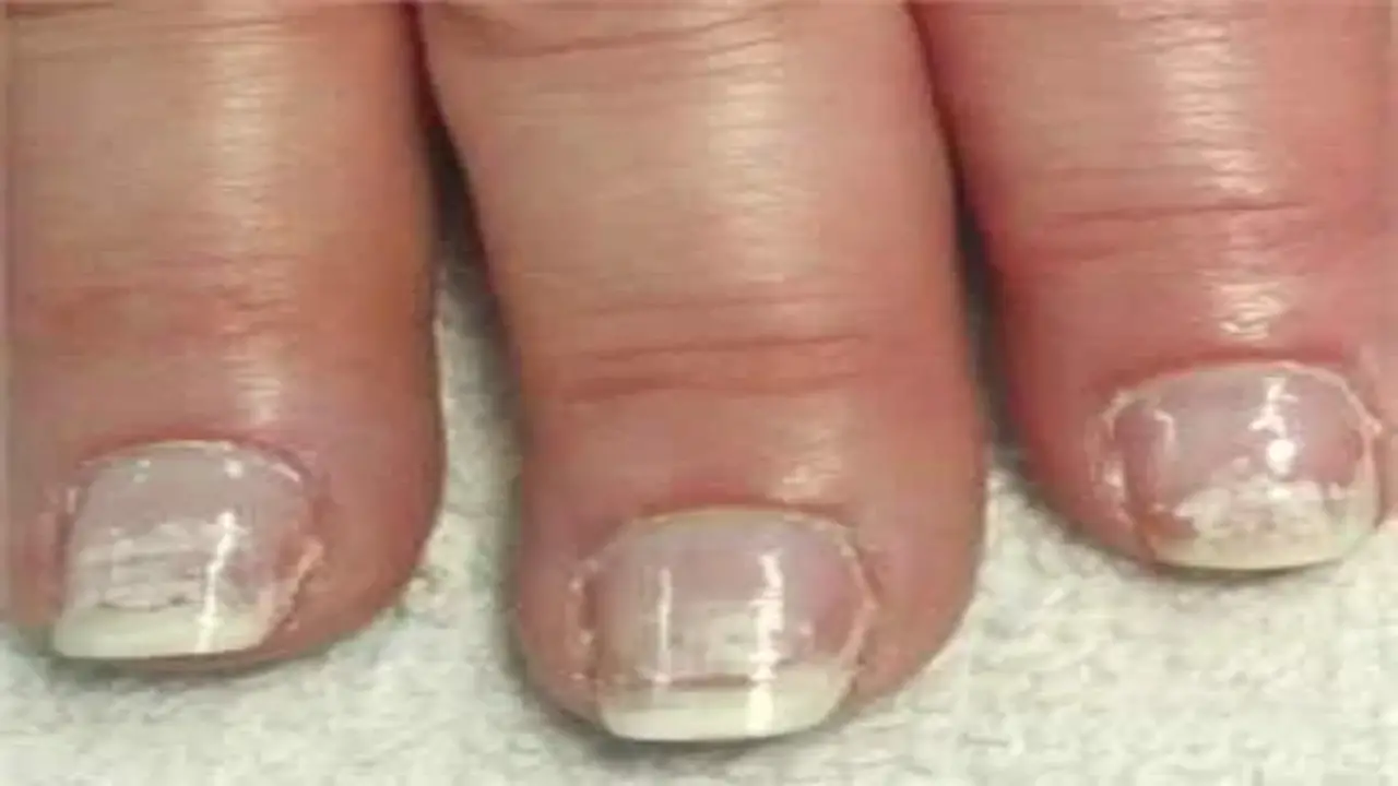 Seeking Professional Help For Nail Repairs And Enhancements