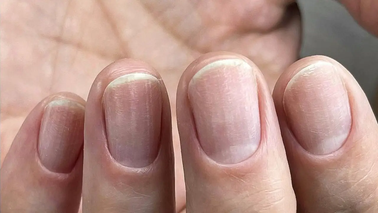 The Potential Risks And Damage To Natural Nails