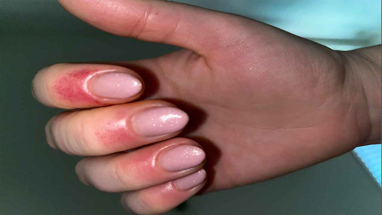 The Potential Risks Of Using Latex-Containing Nail Polish