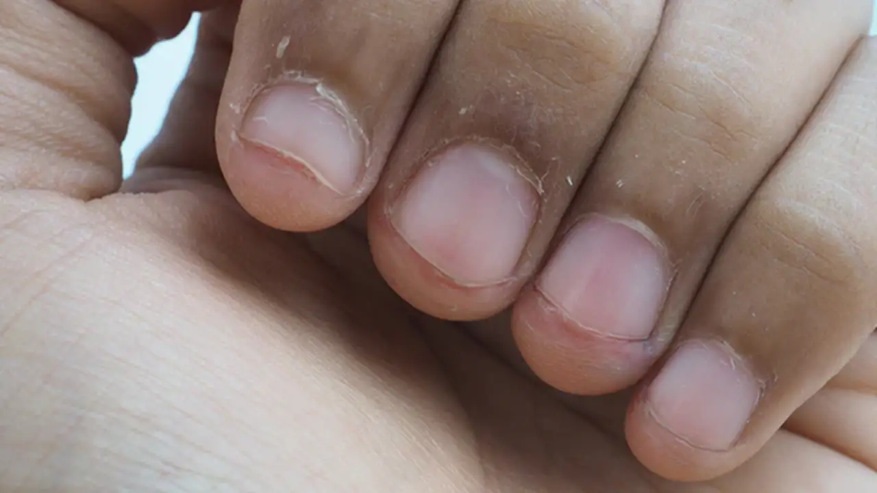 Why Do My Cuticles Peel After A Manicure - Full Discussion